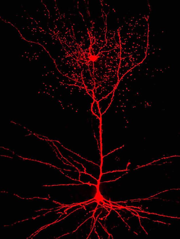 Rosehip and pyramidal neurons