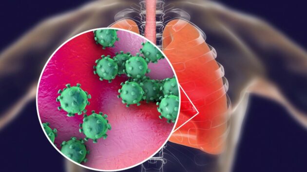 Coronavirus graphic