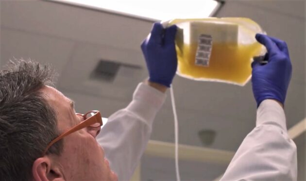 Blood plasma